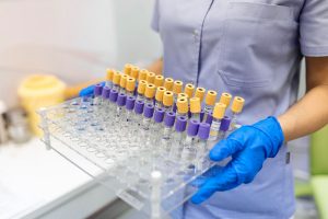 Czech Suspected Monkeypox Case Was Negative; No Cases Detected Yet In Czech Republic