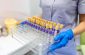 Czech Suspected Monkeypox Case Was Negative; No Cases Detected Yet In Czech Republic
